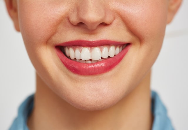 Implantes dentales en Sevilla